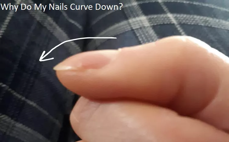 Why Do My Nails Curve Down?